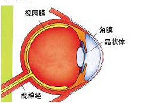 视神经萎缩康复病例