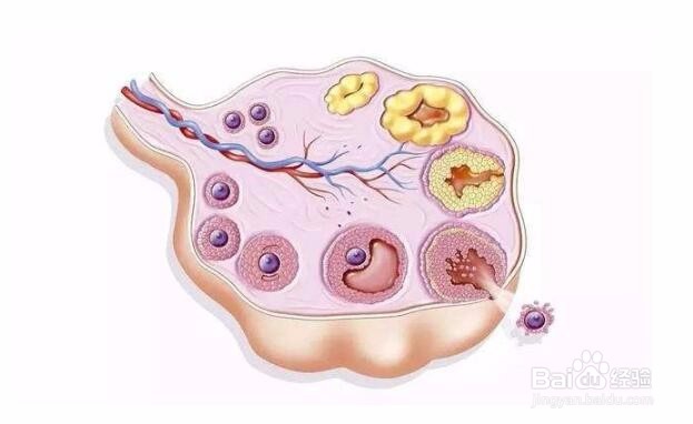汗管瘤加重是雌性激素偏低导致的吗？
