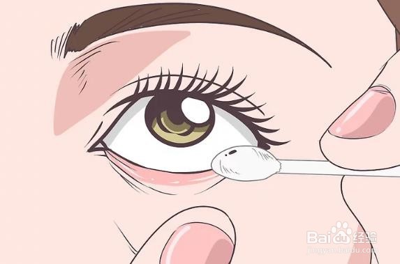 眼睛里进东西怎么弄出来小窍门