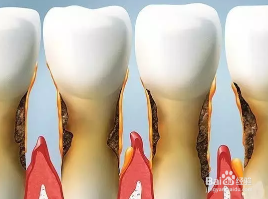 花钱洗一次牙,到底值不值?