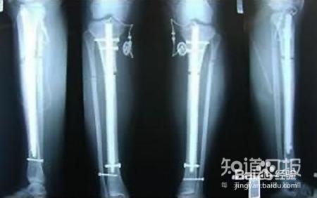 女为知己者——整形还是美容