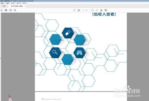 3b8fb4d7726b0ce23261b3b8ef781423bfb9b6dd.jpg?x-bce-process=image%2Fresize%2Cm_lfit%2Cw_500%2Climit_1%2Fquality%2Cq_80