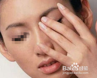 眼膏剂怎么使用