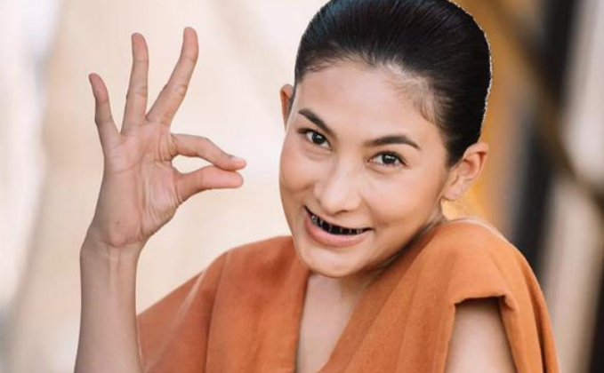 《天生一对》泰国仆人为啥都是黑牙