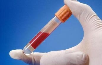 如何正确看待健康体检和防癌检查