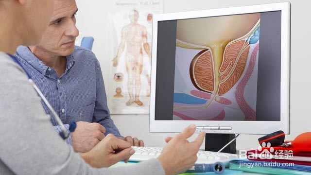 前列腺增生的症状