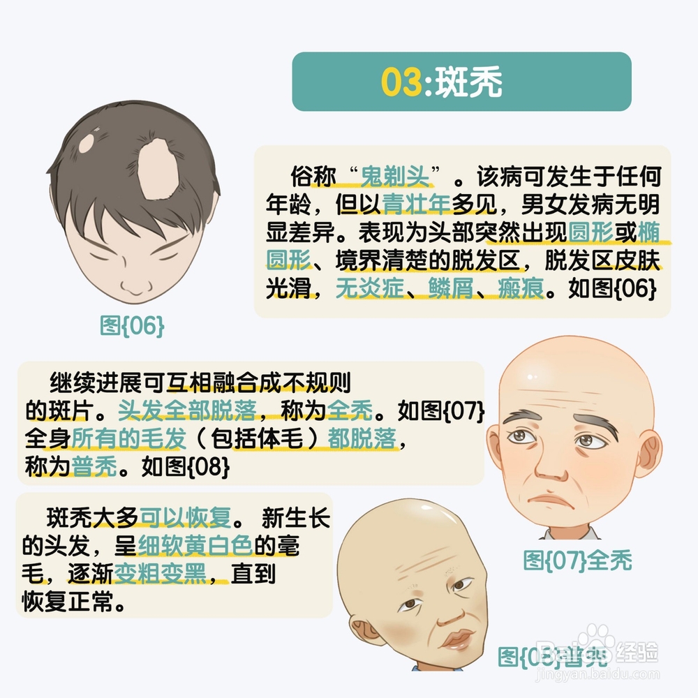 造成脱发的原因