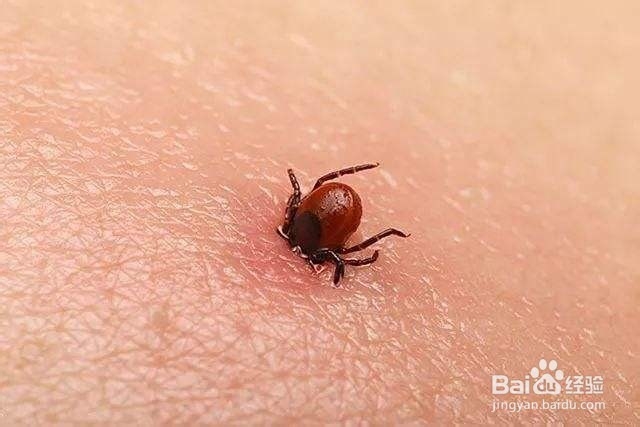 莱姆病是什么?如何预防莱姆病?