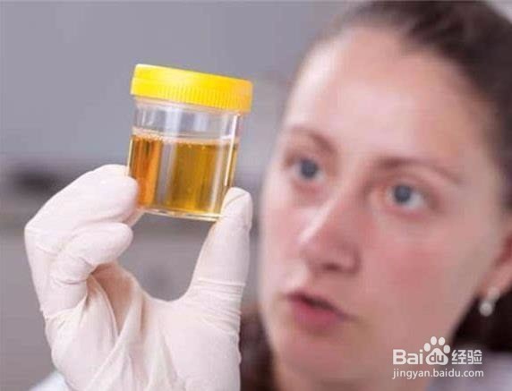 如何从尿的颜色可以判断人的健康状况吗？