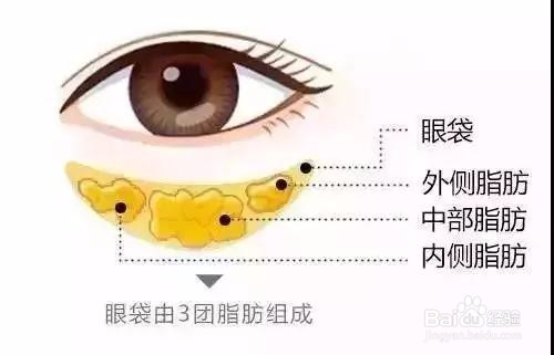祛眼袋的方法