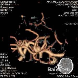 CTA认证的简介跟流程