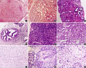 如何看囊胚等级