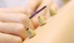 艾灸如何治疗胃痛