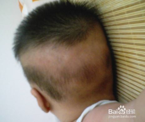 给宝宝剃光头能有助于孩子长好头发吗？