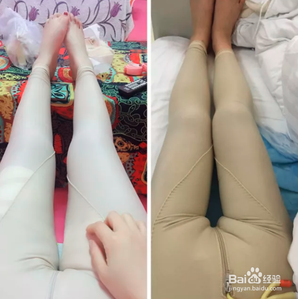朋友产后一直在想要怎么瘦身,最后选择了吸脂