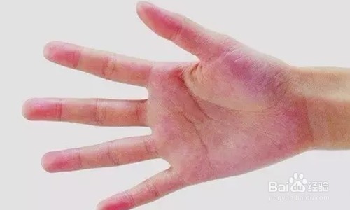 #过年#过年更要注意健康，要注意哪些小变化呢？