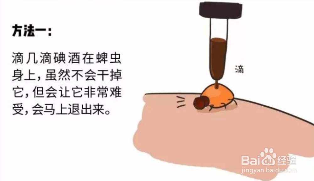 蜱虫叮咬后怎么处理