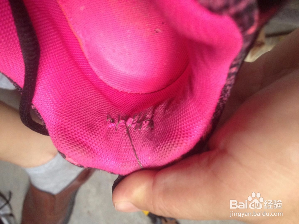 鞋磨脚后跟怎么办