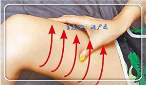 如何消除腿部水肿