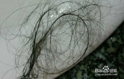 冬季治疗脱发经验和生发方法