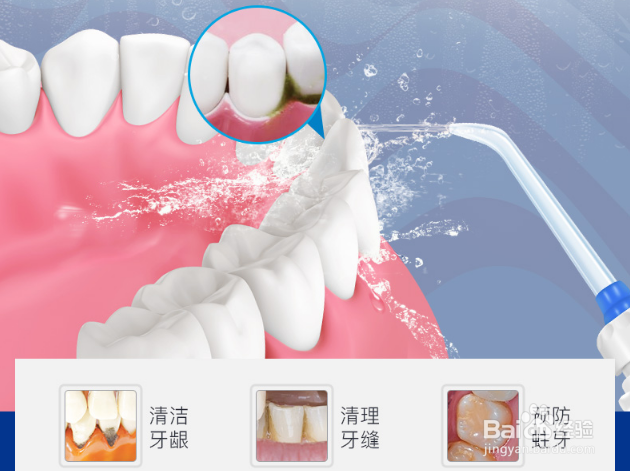冲牙器（水牙线）辅助清洁口腔，冲牙器怎么使用