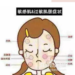 脸上有红血丝怎么治