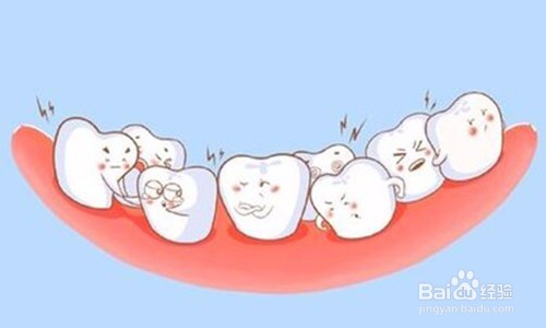 上下牙咬合位置不对叫什么病