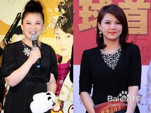 膝关节炎如何保养