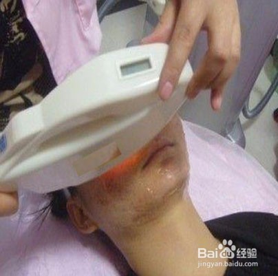 医学祛斑有哪些方法？医学祛斑价格多少？