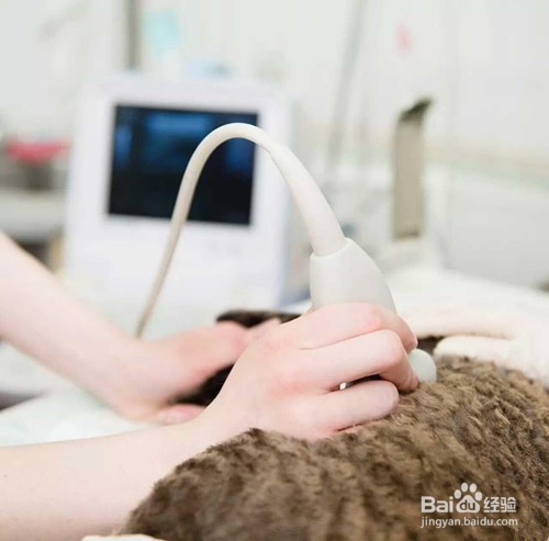 怀孕了,该做哪些检查呢?(上)