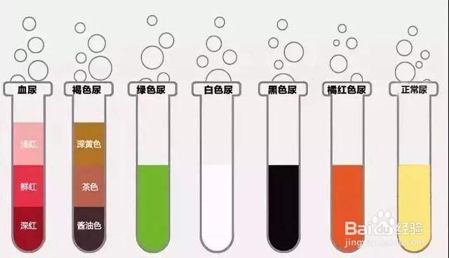 从尿尿的颜色，判断你的身体健康状况