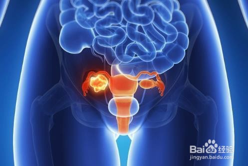 腹痛可以是什么病的症状?