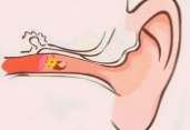 眼睛、耳道和鼻腔的处理小妙招？