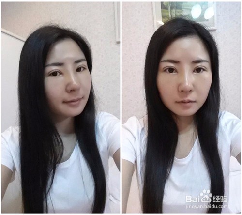 做了双眼皮，整个人美美哒