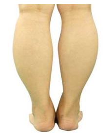 怎么让小腿变得纤细?