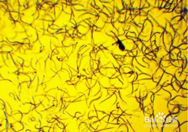 根线虫有什么危害？生姜的根结线虫怎么消灭？