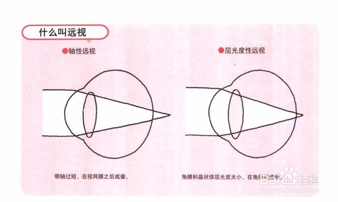怎样保护眼睛？方法和食疗