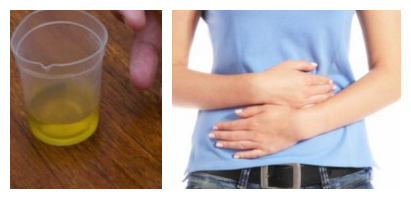 肾阴虚与肾阳虚的简易的区分方法