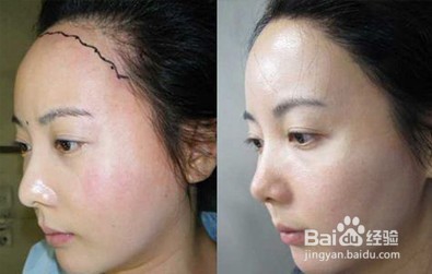 发际线过高怎么办?高额头适合留什么发型?