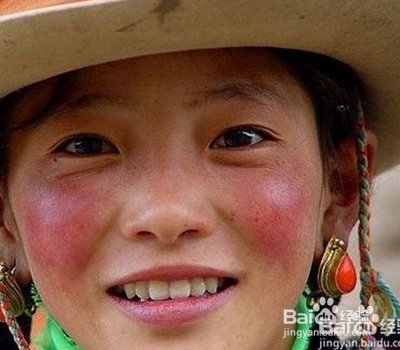 问题面部肌肤的护理