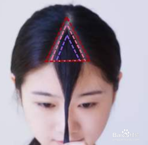 刘海三角区秃了怎么办