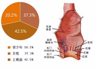 肛裂如何自愈