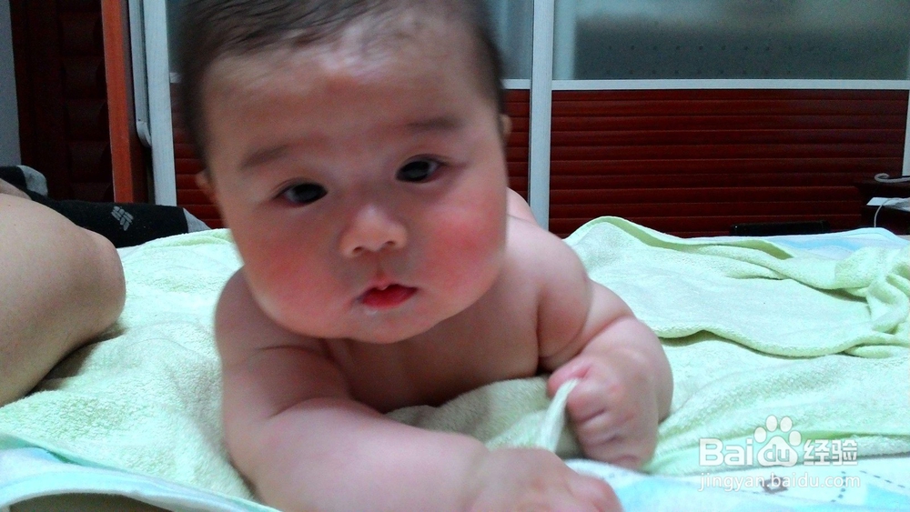 可以不用手术治疗“幽门痉挛