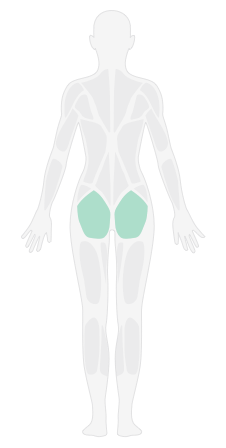 左侧箭步蹲_膝前侧疼痛缓解阶段1