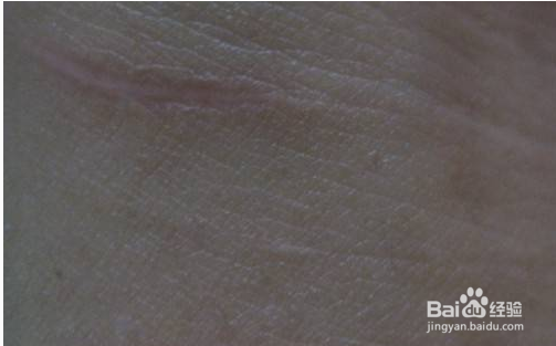 最好的祛斑方法