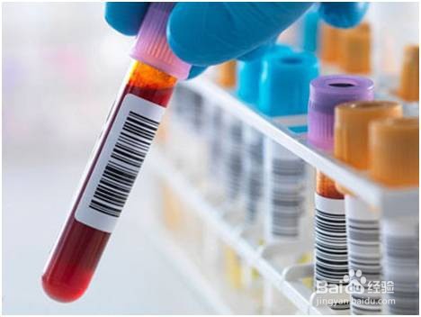 胃部体检的主要方式有哪些