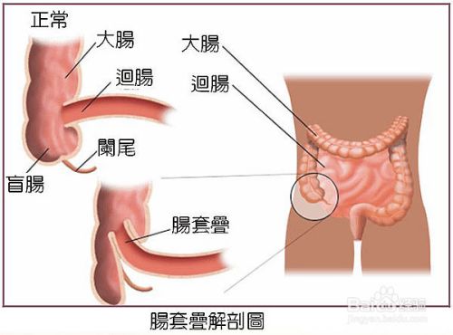 宝宝肚子痛怎么办 百度经验