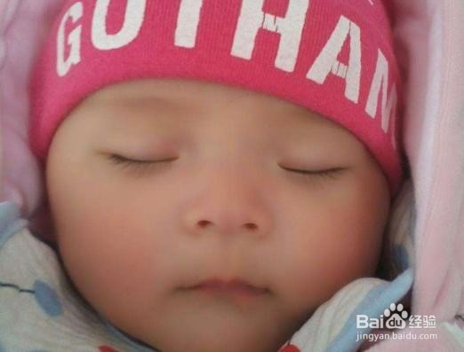 蛋白质能量营养不良常见问题以及处理措施