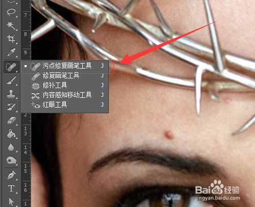 怎么简单地用PS祛斑祛痘