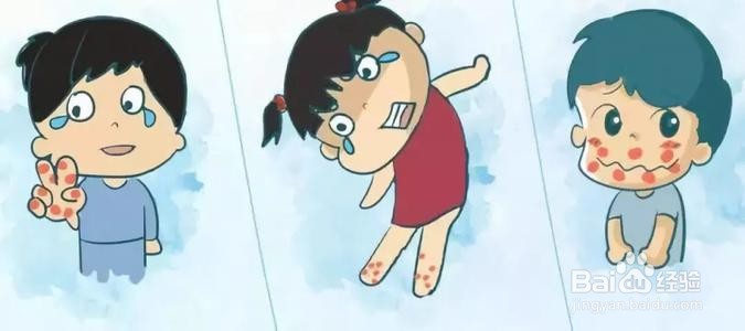 手足口病如何预防和应对